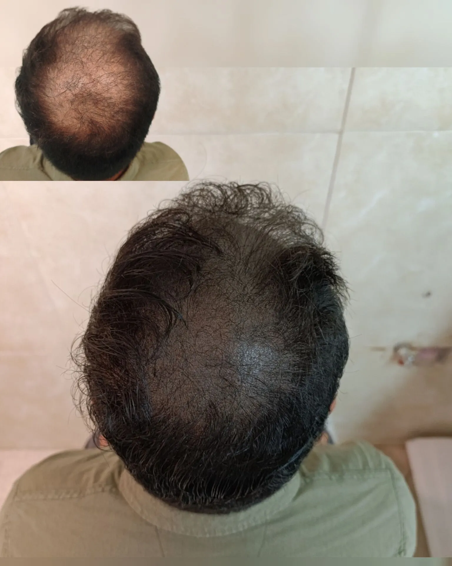 نمونه میکرواسکالپ